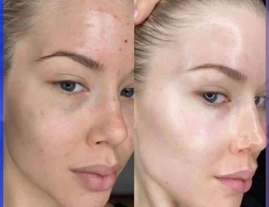 Collagen Gel Night Mask